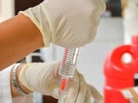 Medical professional wearing gloves is preparing the regenerative stem cell solution by drawing it into a syringe from the treatment vial.
