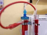 stratos-eboo-purifying-patients-blood