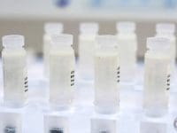 vials-of-stem-cells-1